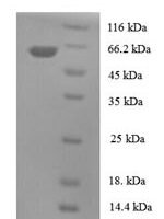 Human Tubulin-specific chaperone cofactor E-like protein (TBCEL) Recombinant Protein - BioCrest Sci