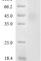 Mouse Adhesion G-protein coupled receptor G1 (Adgrg1), partial Recombinant Protein, C-10His - BioCrest Sci