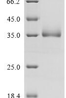 Human Vesicular integral-membrane protein VIP36 (LMAN2), partial Recombinant Protein - BioCrest Sci