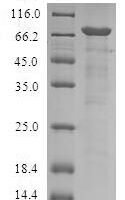 Human Serpin B9 (SERPINB9) Recombinant Protein - BioCrest Sci