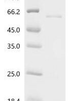 Mouse Interferon regulatory factor 9 (Irf9) Recombinant Protein - BioCrest Sci