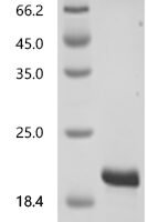 Human SH3 and PX domain-containing protein 2A (SH3PXD2A), partial Recombinant Protein, C-His - BioCrest Sci