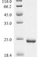 Anacardium occidentale 2s albumin (ana o 3) Recombinant Protein - BioCrest Sci