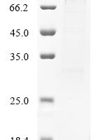 Human papillomavirus type 18 Major capsid protein L1 (L1) Recombinant Protein - BioCrest Sci