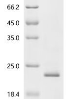 Human Calcium homeostasis modulator protein 2 (CALHM2), partial Recombinant Protein - BioCrest Sci