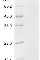 Human Proliferation marker protein Ki-67 (MKI67), partial Recombinant Protein, C-His - BioCrest Sci