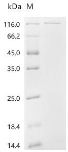 Human Proliferation marker protein Ki-67 (MKI67), partial Recombinant Protein, C-His, Homo sapiens (Human), E.coli, C-terminal 6xHis-tagged, 83.8 kDa, purity >≥ 85% as determined by SDS-PAGE.