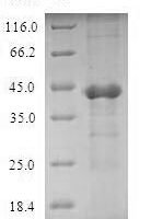 Human Ubiquitin-conjugating enzyme E2 D4 (UBE2D4) Recombinant Protein - BioCrest Sci