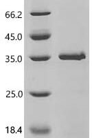 Human Meiotic nuclear division protein 1 homolog (MND1) Recombinant Protein - BioCrest Sci