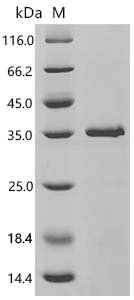 Human Meiotic nuclear division protein 1 homolog (MND1) Recombinant Protein, Homo sapiens (Human), E.coli, C-terminal 6xHis-tagged, 30.5 kDa, purity >≥ 90% as determined by SDS-PAGE.