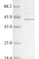 Human Hyaluronan and proteoglycan link protein 1 (HAPLN1) Recombinant Protein - BioCrest Sci