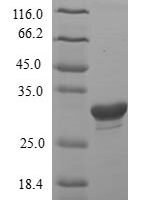 Rat Insulin-like growth factor-binding protein 1 (Igfbp1) Recombinant Protein, Tag-Free - BioCrest Sci