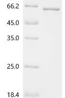 Human Arylsulfatase B (ARSB) Recombinant Protein, N-His, aa 37–533, E.coli - BioCrest Sci