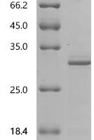 Human Sigma non-opioid intracellular receptor 1 (SIGMAR1), partial Recombinant Protein, N-His - BioCrest Sci
