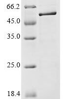 Avian infectious bronchitis virus Nucleoprotein (N) Recombinant Protein, C-His, aa 1–409, strain Vic S - BioCrest Sci