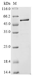 Avian infectious bronchitis virus Nucleoprotein (N) Recombinant Protein, C-His, aa 1–409, strain Vic S, Avian infectious bronchitis virus (strain Vic S) (IBV), E.coli, C-terminal 6xHis-tagged, 46.1 kDa, purity >≥ 85% as determined by SDS-PAGE.