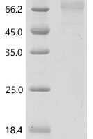Human Thyrotropin receptor (TSHR), partial Recombinant Protein, N-His - BioCrest Sci