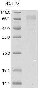 Human Thyrotropin receptor (TSHR), partial Recombinant Protein, N-His, Homo sapiens (Human), Mammalian cell, N-terminal 6xHis-tagged, 47.5 kDa, purity >≥ 85% as determined by SDS-PAGE.