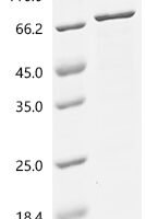 Human Roundabout homolog 4 (ROBO4), partial Recombinant Protein - BioCrest Sci
