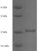 Human ADP-ribosylation factor-like protein 4A (ARL4A) Recombinant Protein, N-His - BioCrest Sci