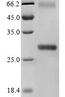 Human 3-oxo-5-alpha-steroid 4-dehydrogenase 1 (SRD5A1) Recombinant Protein - BioCrest Sci