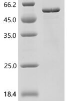 Human RNA demethylase ALKBH5 (ALKBH5) Recombinant Protein - BioCrest Sci