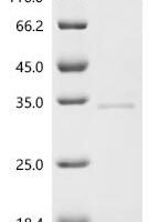Macaca fascicularis Cathepsin K (CTSK) Recombinant Protein - BioCrest Sci
