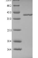 Pig Coagulation factor XII (F12), partial Recombinant Protein - BioCrest Sci