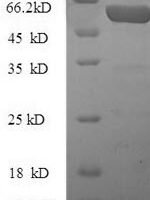 Mouse CCN family member 2 (Ccn2), partial Recombinant Protein, N-10His-SUMO - BioCrest Sci
