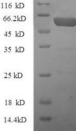 Mouse CCN family member 2 (Ccn2), partial Recombinant Protein, N-10His-SUMO, Mus musculus (Mouse), E.coli, N-terminal 10xHis-SUMO-tagged, 53.5 kDa, purity >≥ 90% as determined by SDS-PAGE.