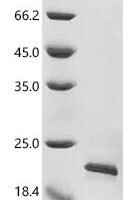 Human immunodeficiency virus type 1 group M subtype B Protein Vpr (vpr) Recombinant Protein - BioCrest Sci