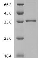 Human F-box only protein 17 (FBXO17) Recombinant Protein - BioCrest Sci