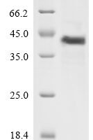 Human Complement decay-accelerating factor (CD55), partial Recombinant Protein - BioCrest Sci