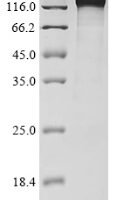 Human Nuclear pore complex protein Nup98-Nup96 (NUP98), partial Recombinant Protein - BioCrest Sci