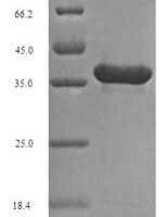 Human Fibroblast growth factor 10 (FGF10), partial Recombinant Protein, N-His-SUMO, aa 37–208 - BioCrest Sci