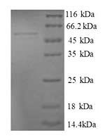 Human 39S ribosomal protein L9, mitochondrial (MRPL9) Recombinant Protein - BioCrest Sci
