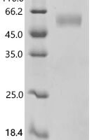 Mouse Immunoglobulin heavy constant epsilon (IGHE), partial Recombinant Protein - BioCrest Sci