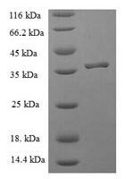 Human Peptidyl-tRNA hydrolase ICT1, mitochondrial (ICT1) Recombinant Protein - BioCrest Sci