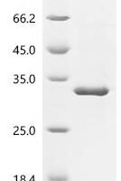 Mouse Syntaxin-binding protein 6 (Stxbp6) Recombinant Protein - BioCrest Sci