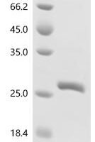 Human GTPase KRas (KRAS) (G12C), partial Recombinant Protein, N-His - BioCrest Sci