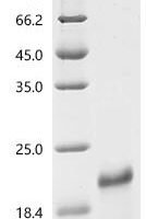 Human Coagulation factor X (F10), partial Recombinant Protein, N-His, aa 86–165, E.coli - BioCrest Sci