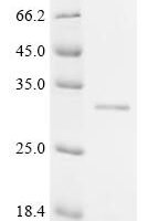 Epstein-Barr virus Epstein-Barr nuclear antigen 2 (EBNA2), partial Recombinant Protein, C-His, aa 320–487, Yeast - BioCrest Sci