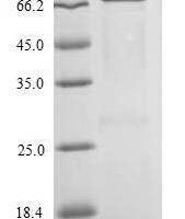 Influenza A virus Nucleoprotein (NP) Recombinant Protein, N-His-SUMO - BioCrest Sci