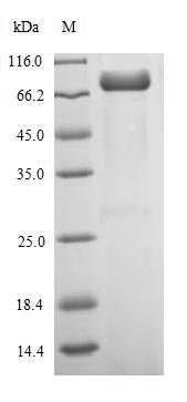 Influenza A virus Nucleoprotein (NP) Recombinant Protein, N-His-SUMO, Influenza A virus, E.coli, N-terminal 6xHis-SUMO-tagged, 72.2 kDa, purity >≥ 90% as determined by SDS-PAGE.