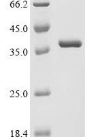 Human 14-3-3 protein zeta/delta (YWHAZ) Recombinant Protein - BioCrest Sci