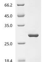 Human Diamine acetyltransferase 1(SAT1), partial Recombinant Protein - BioCrest Sci