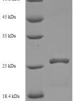 Human HLA-DMA protein (HLA-DMA), partial Recombinant Protein - BioCrest Sci