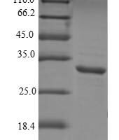 Human Aquaporin-1 (AQP1), partial Recombinant Protein - BioCrest Sci