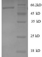 Human Heterogeneous nuclear ribonucleoprotein D0 (HNRNPD), partial Recombinant Protein - BioCrest Sci