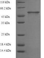 Clostridium tetani Tetanus toxin (tetX), partial Recombinant Protein, N-His - BioCrest Sci